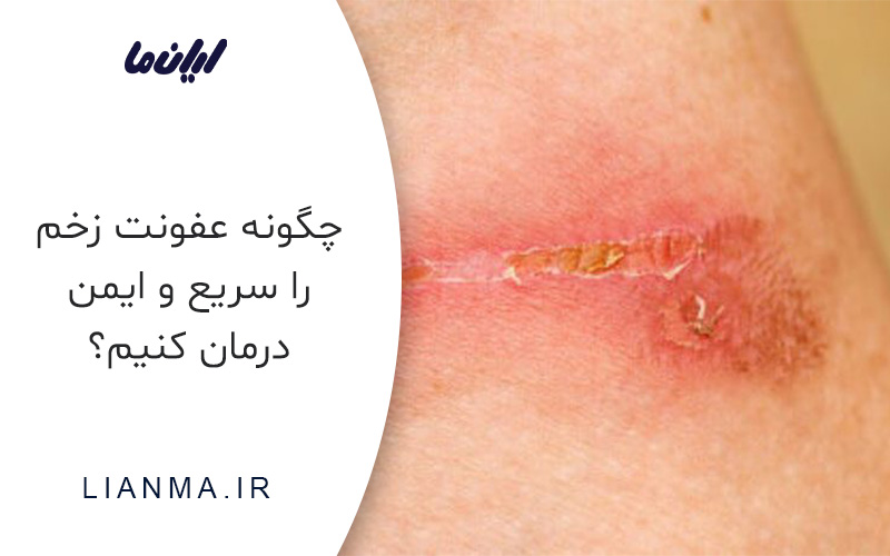 چگونه عفونت زخم را سریع و ایمن درمان کنیم؟